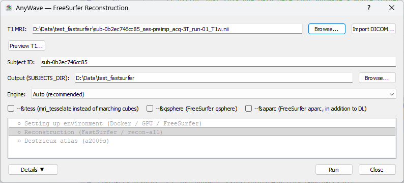 FreeSurfer Reconstruction dialog